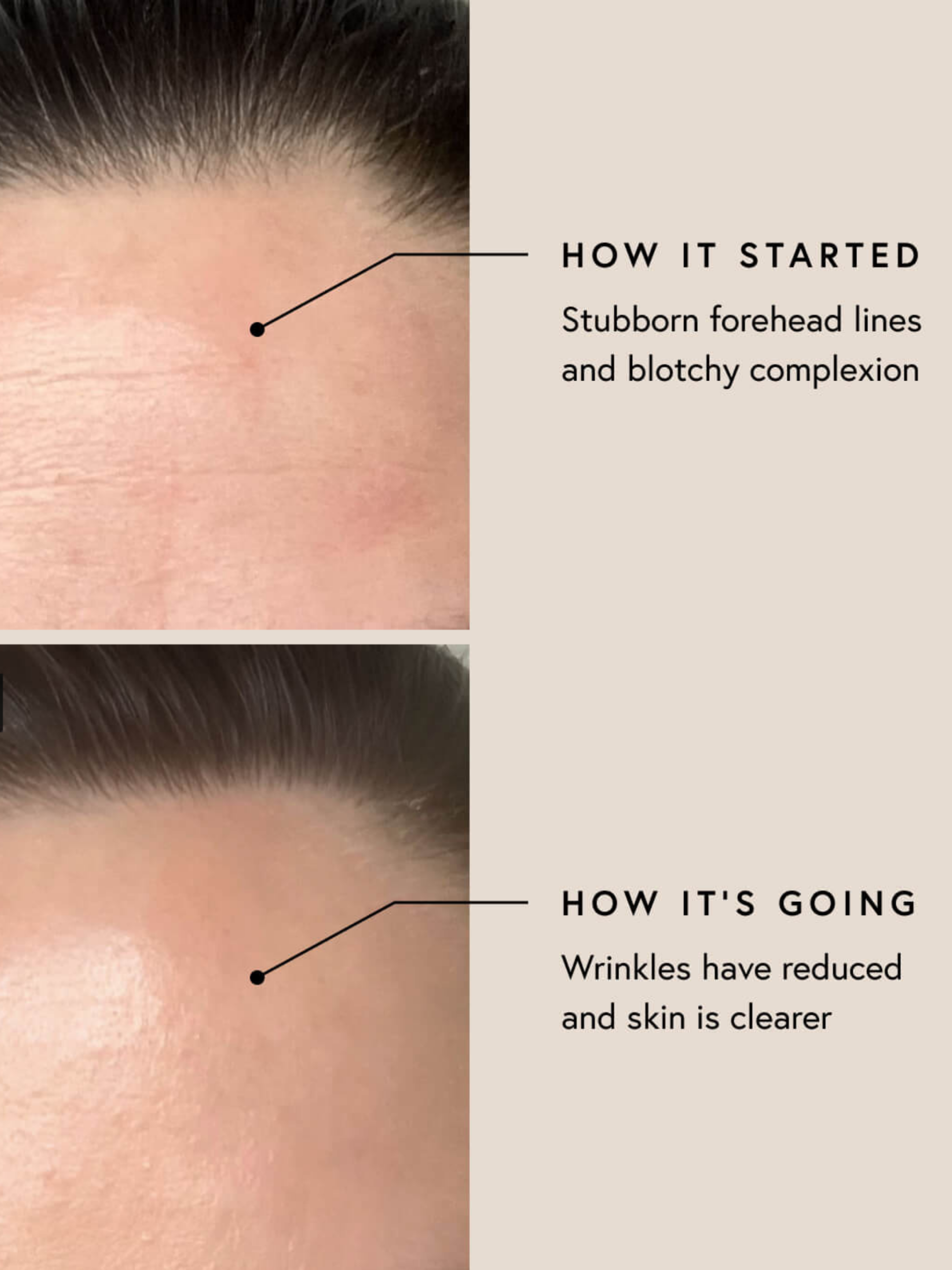 Before and After MUMUK Photos