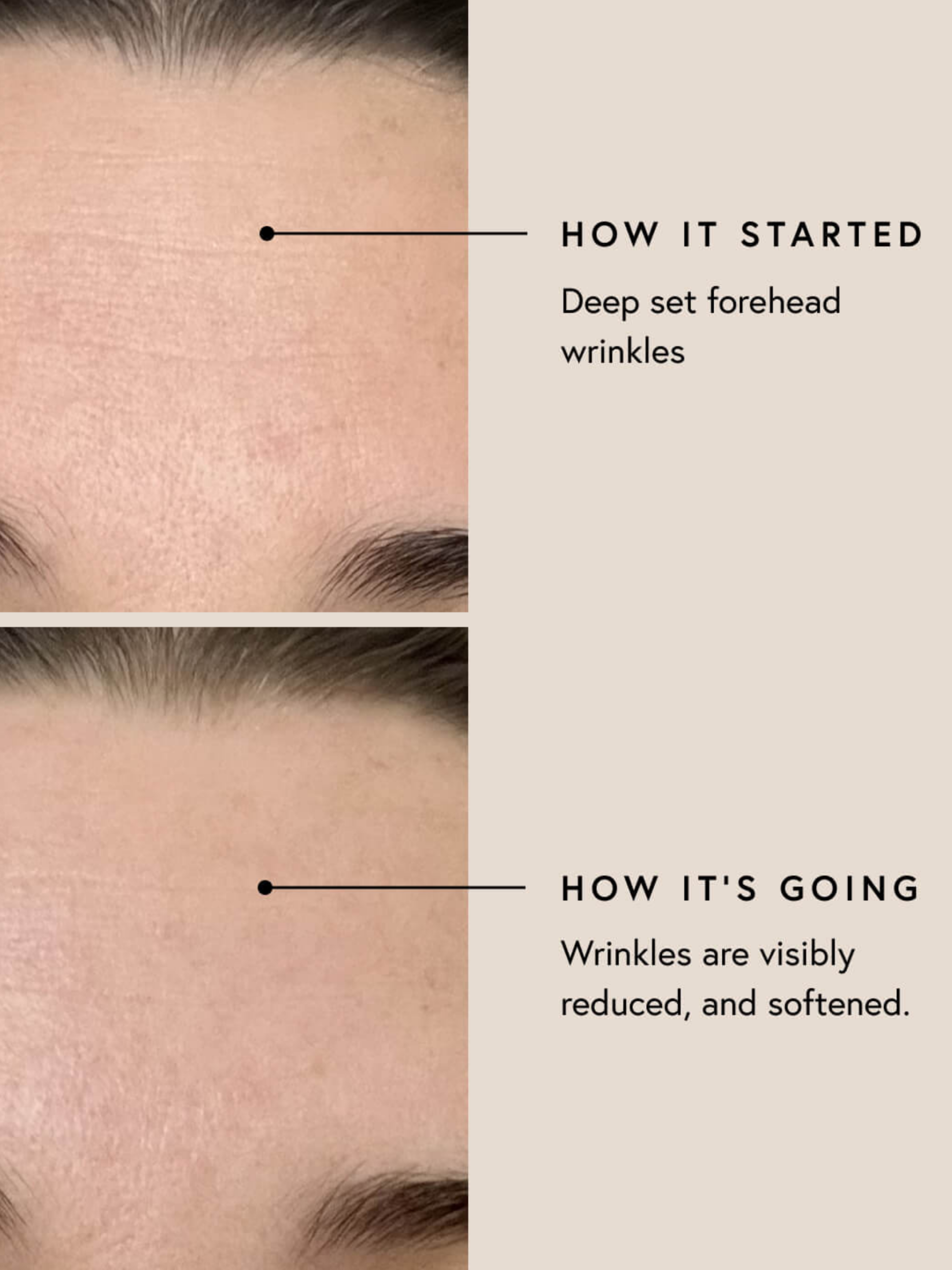 Before and After MUMUK Photos